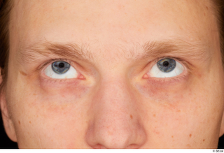 Stanley Johnson eye 0005.jpg